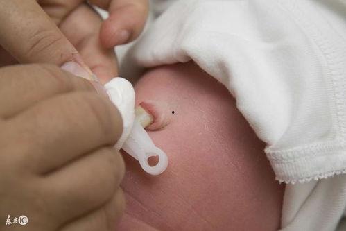 脐带护理视频,新手爸妈必看视频教程